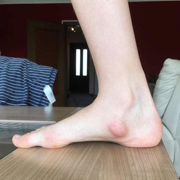 SK8INSOLL® DOUBLE AXEL カスタマイズインソール サイズ S