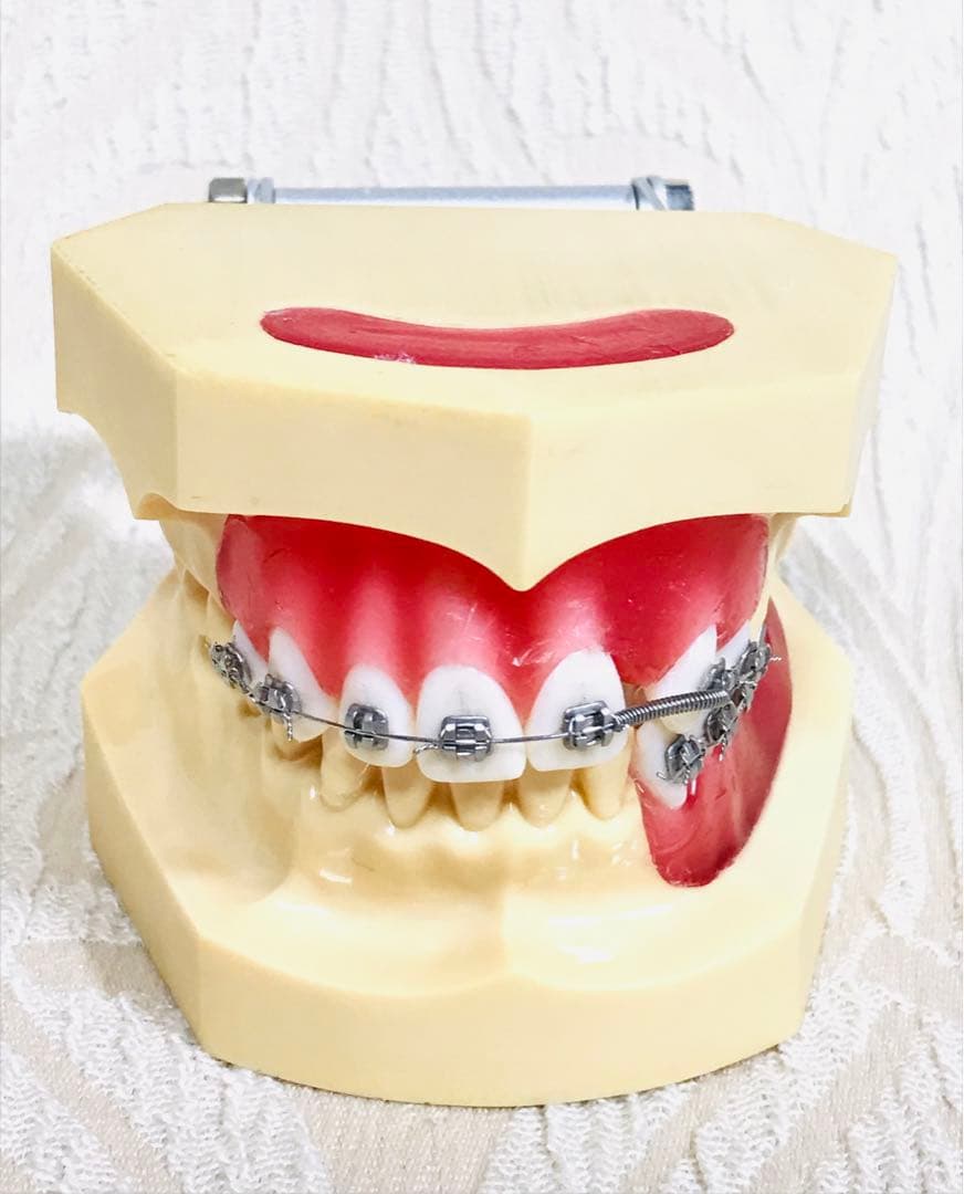 NISSIN DENTAL STUDY MODEL 矯正  歯　模型