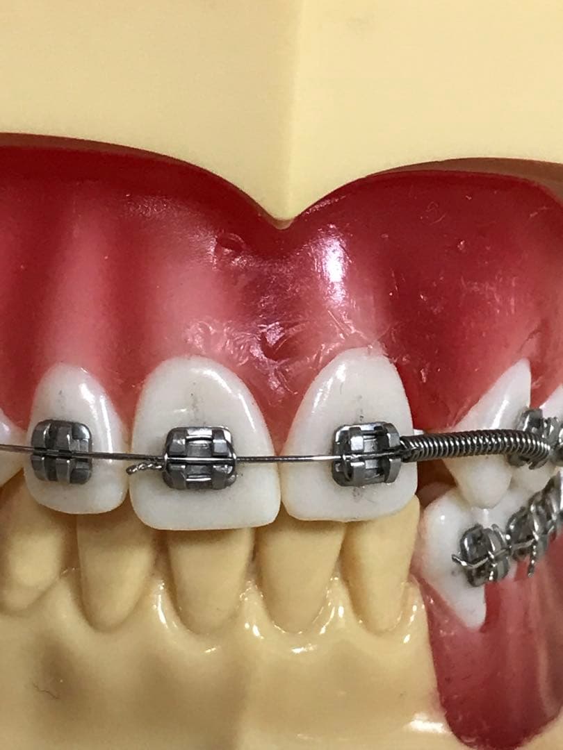 NISSIN DENTAL STUDY MODEL 矯正  歯　模型